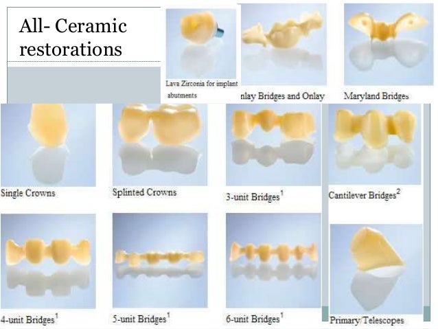 Ceramic restorations