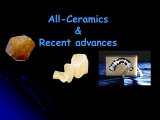 All-Ceramics
&
Recent advances
 