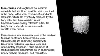 DENTAL CERAMICS | PPTX