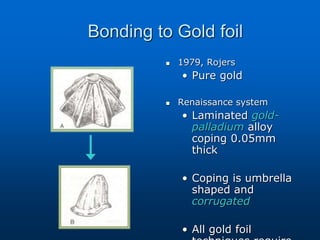 Bonding to Gold foil
 1979, Rojers
• Pure gold
 Renaissance system
• Laminated gold-
palladium alloy
coping 0.05mm
thick
• Coping is umbrella
shaped and
corrugated
• All gold foil
 
