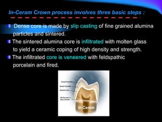 In-Ceram Crown process involves three basic steps :
Dense core is made by slip casting of fine grained alumina
particles and sintered.
The sintered alumina core is infiltrated with molten glass
to yield a ceramic coping of high density and strength.
The infiltrated core is veneered with feldspathic
porcelain and fired.
 