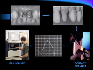 MILLING UNIT CONTACT
SCANNER
 