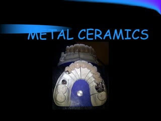 METAL CERAMICS
 