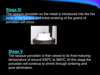 Stage IV
The opaque porcelain on the metal is introduced into the hot
zone of the furnace and initial sintering of the grains of
porcelain will occur.
Stage V
The opaque porcelain is then raised to its final maturing
temperature of around 9300C to 9600C. At this stage the
porcelain will continue to shrink through sintering and
pore elimination.
 