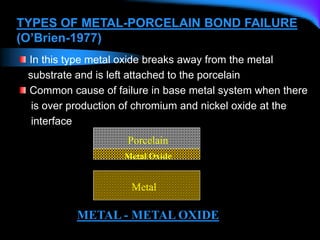 Metal
METAL - METAL OXIDE
Porcelain
Metal Oxide
TYPES OF METAL-PORCELAIN BOND FAILURE
(O’Brien-1977)
In this type metal oxide breaks away from the metal
substrate and is left attached to the porcelain
Common cause of failure in base metal system when there
is over production of chromium and nickel oxide at the
interface
 