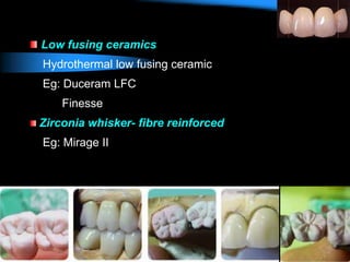 Low fusing ceramics
Hydrothermal low fusing ceramic
Eg: Duceram LFC
Finesse
Zirconia whisker- fibre reinforced
Eg: Mirage II
 