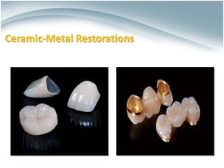 Ceramics for Dental Restorations , Ceramic-Metal Restorations ,All ...