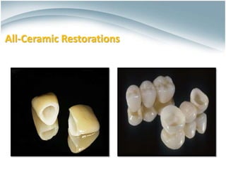 Ceramics for Dental Restorations , Ceramic-Metal Restorations ,All ...