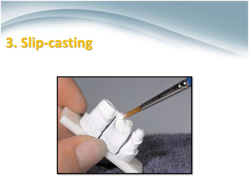 Ceramics for Dental Restorations , CeramicMetal Restorations ,AllCe…