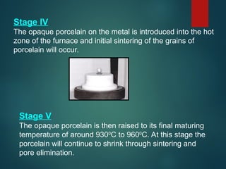 Stage IV
The opaque porcelain on the metal is introduced into the hot
zone of the furnace and initial sintering of the grains of
porcelain will occur.
Stage V
The opaque porcelain is then raised to its final maturing
temperature of around 9300
C to 9600
C. At this stage the
porcelain will continue to shrink through sintering and
pore elimination.
 