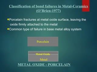 Classification of bond failures in Metal-Ceramics
(O’Brien-1977)
Porcelain
Metal
Metal Oxide
METAL OXIDE - PORCELAIN
Porcelain fractures at metal oxide surface, leaving the
oxide firmly attached to the metal
Common type of failure in base metal alloy system
 