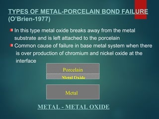 Metal
METAL - METAL OXIDE
Porcelain
Metal Oxide
TYPES OF METAL-PORCELAIN BOND FAILURE
(O’Brien-1977)
In this type metal oxide breaks away from the metal
substrate and is left attached to the porcelain
Common cause of failure in base metal system when there
is over production of chromium and nickel oxide at the
interface
 