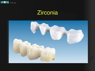 Ceramics in fixed prosthodontics considerations for use in dental ...