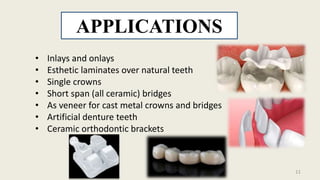 • Inlays and onlays
• Esthetic laminates over natural teeth
• Single crowns
• Short span (all ceramic) bridges
• As veneer for cast metal crowns and bridges
• Artificial denture teeth
• Ceramic orthodontic brackets
APPLICATIONS
11
 