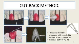 CUT BACK METHOD.
• Thickness should be
measured with rounded tip
IWANSON PATTERN GAUSE
• It should be from 0.3-0.5
21
 