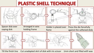 Spacer disk over
coping disk
Arranged in wire
holding frame
Holder is placed over
flame
Press the die forcefully
against the softened disks
Till the finish line Cut unadapted skirt of disk with iris scissor 1mm short and filled with wax
22
 