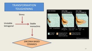 TRANSFORMATION
TOUGHENING
Stress
Unstable
tetragonal
Stable
monoclinic
ZIRCONIA BASED
CERAMICS
39
 