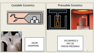 Pressable Ceramics
IPIPS EMPRESS 2
OPC 3G
FINESSE PRESSABLE
Castable Ceramics
DICOR
CERAPEARL
47
 