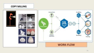 COPY MILLING
WORK-FLOW
51
 