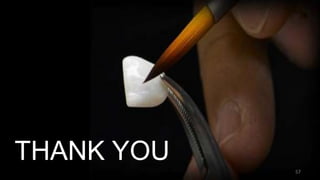 THANK YOU
57
 