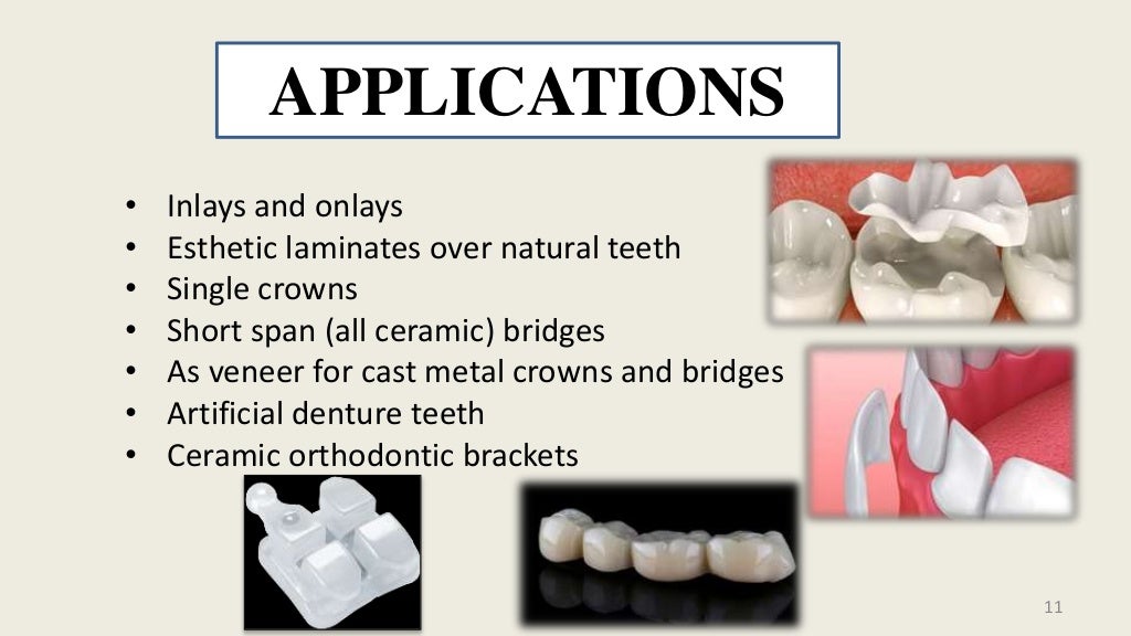 Dental Ceramics