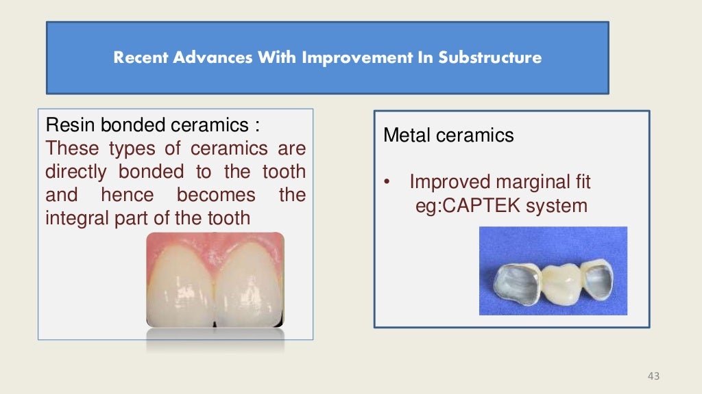 Dental Ceramics