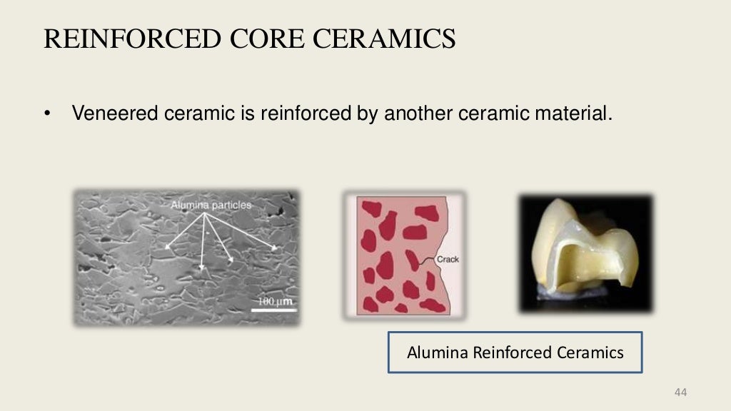 Dental Ceramics