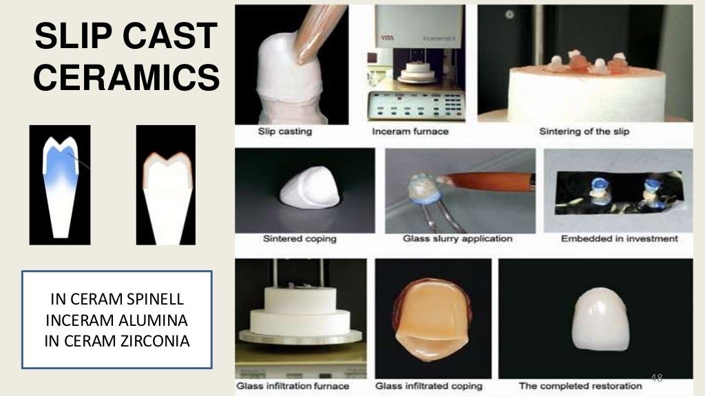 Dental Ceramics