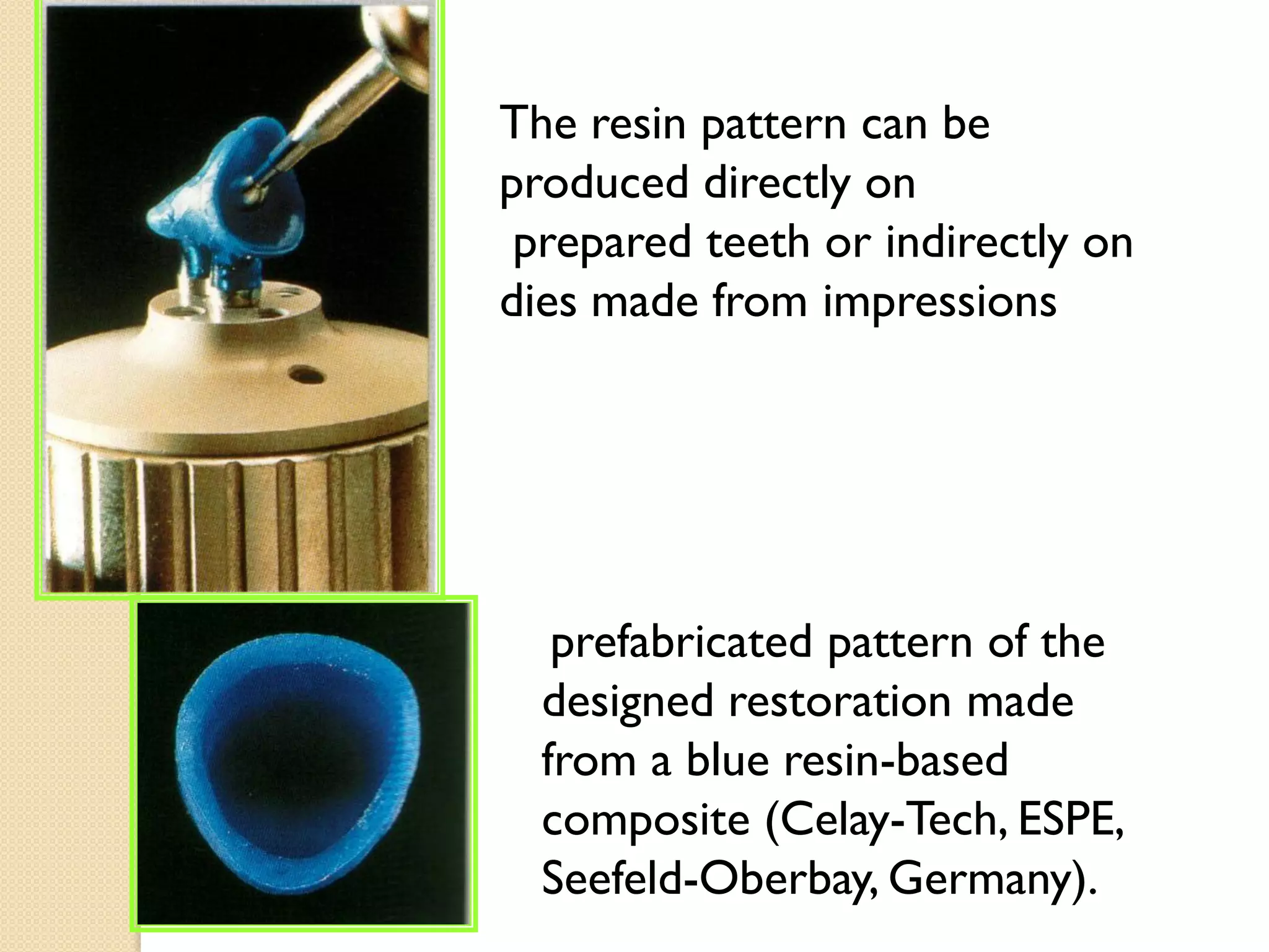 Dental Ceramics PART 3 | PDF