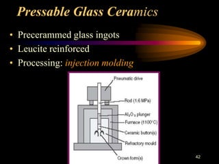 Pressable Glass Ceramics
• Precerammed glass ingots
• Leucite reinforced
• Processing: injection molding
42
 