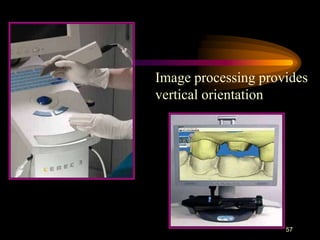 57
Image processing provides
vertical orientation
 