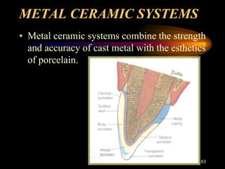 METAL CERAMIC SYSTEMS
• Metal ceramic systems combine the strength
and accuracy of cast metal with the esthetics
of porcelain.
63
 