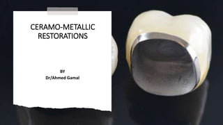 CERAMO-METALLIC
RESTORATIONS
BY
Dr/Ahmed Gamal
 