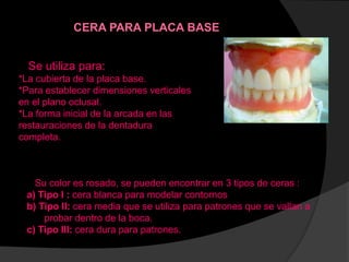 Se utiliza para:
*La cubierta de la placa base.
*Para establecer dimensiones verticales
en el plano oclusal.
*La forma inicial de la arcada en las
restauraciones de la dentadura
completa.
CERA PARA PLACA BASE
Su color es rosado, se pueden encontrar en 3 tipos de ceras :
a) Tipo I : cera blanca para modelar contornos
b) Tipo II: cera media que se utiliza para patrones que se vallan a
probar dentro de la boca.
c) Tipo III: cera dura para patrones.
 