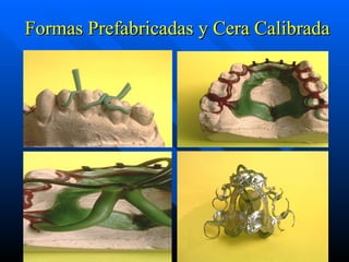 Formas Prefabricadas y Cera Calibrada 