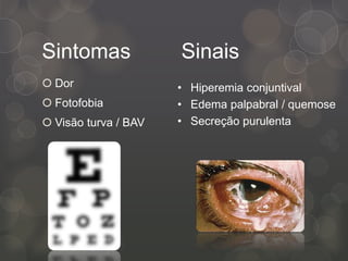 Sintomas
 Dor
 Fotofobia
 Visão turva / BAV
Sinais
• Hiperemia conjuntival
• Edema palpabral / quemose
• Secreção purulenta
 
