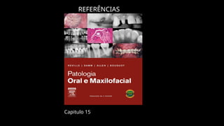 REFERÊNCIAS
Capitulo 15
 