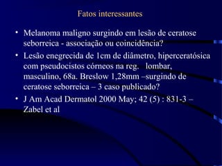 Fatos interessantes
• Melanoma maligno surgindo em lesão de ceratose
seborreica - associação ou coincidência?
• Lesão enegrecida de 1cm de diâmetro, hiperceratósica
com pseudocistos córneos na reg. lombar,
masculino, 68a. Breslow 1,28mm –surgindo de
ceratose seborreica – 3 caso publicado?
• J Am Acad Dermatol 2000 May; 42 (5) : 831-3 –
Zabel et al
 