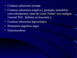 • Ceratose seborreica irritada
• Ceratose seborreica eruptiva ( gestação, transitória
com eritrodermia, sinal de Léser-Trélat= neo maligna
visceral TGI , linfoma ou leucemia ).
• Ceratose seborreica hipocrômica
• Dermatose papulosa nigra
• Estucoceratose
 