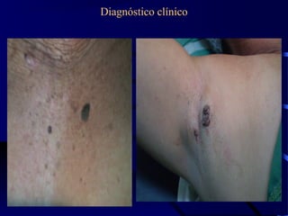 Diagnóstico clínico
 