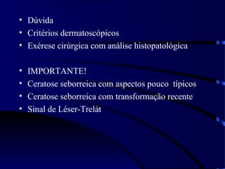 • Dúvida
• Critérios dermatoscópicos
• Exérese cirúrgica com análise histopatológica
• IMPORTANTE!
• Ceratose seborreica com aspectos pouco típicos
• Ceratose seborreica com transformação recente
• Sinal de Léser-Trelát
 