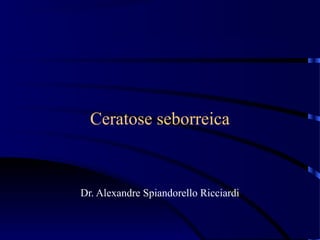 Ceratose seborreica
Dr. Alexandre Spiandorello Ricciardi
 