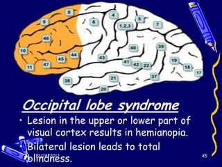 Occipital lobe syndrome
• Lesion in the upper or lower part of
  visual cortex results in hemianopia.
• Bilateral lesion leads to total
  blindness.
    12/28/2012                           45
 