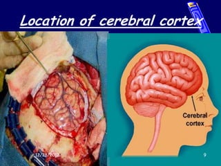 Location of cerebral cortex




  12/28/2012                  9
 
