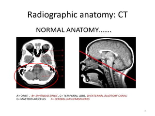 Radiographic anatomy: CT
3
 