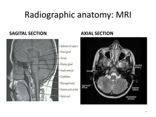 Radiographic anatomy: MRI
SAGITAL SECTION AXIAL SECTION
4
 