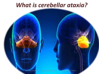 Cerebellar Ataxia PPSX cerebellar-ataxia-ppsx