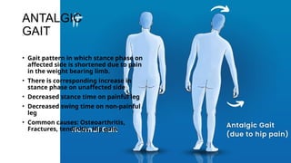 Comprehensive Cerebellar Examination and Gait Analysis in Neurological ...