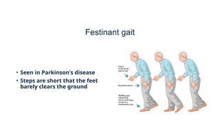 Festinating Comprehensive Cerebellar Examination and Gait Analysis in Neurological ...