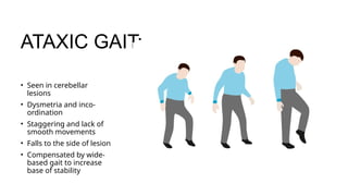 Comprehensive Cerebellar Examination and Gait Analysis in Neurological ...